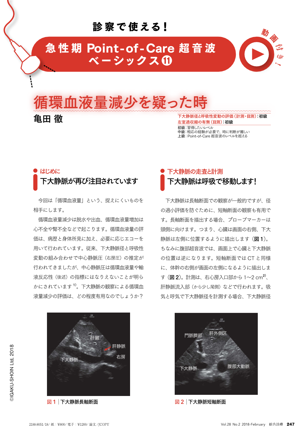 循環血液量減少を疑った時 総合診療 28巻2号 医書 Jp