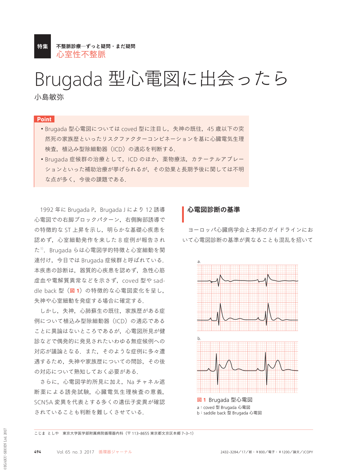 Brugada型心電図に出会ったら (循環器ジャーナル 65巻3号) | 医書.jp