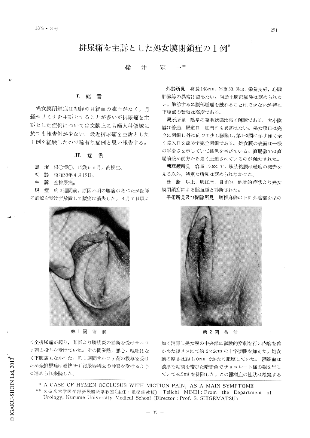 排尿痛を主訴とした処女膜閉鎖症の1例 臨床皮膚泌尿器科 18巻3号 医書 Jp