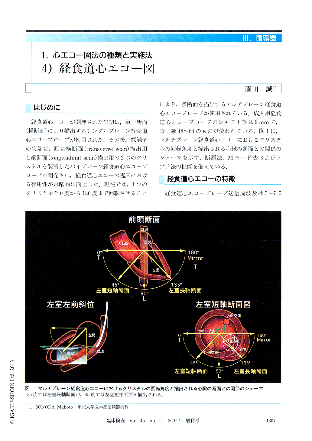 4）経食道心エコー図 (臨床検査 45巻11号) | 医書.jp