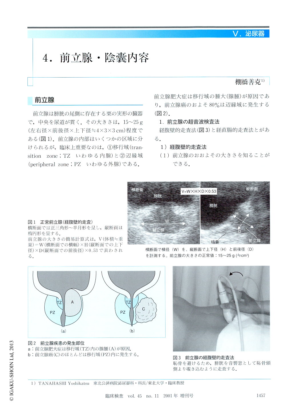 4 前立腺 陰嚢内容 臨床検査 45巻11号 医書 Jp