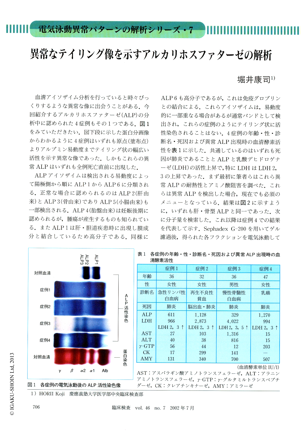 異常なテイリング像を示すアルカリホスファターゼの解析 臨床検査 46巻7号 医書 Jp