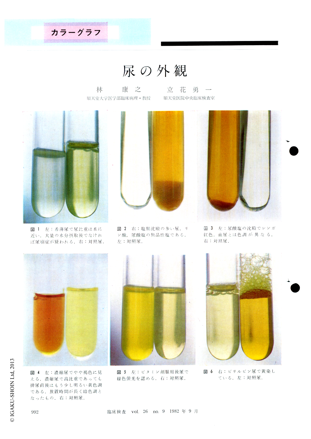 おしっこ 黄 緑 尿の色が教える病気のサイン ピンク 白濁 濃黄 無色透明 Newsポストセブン