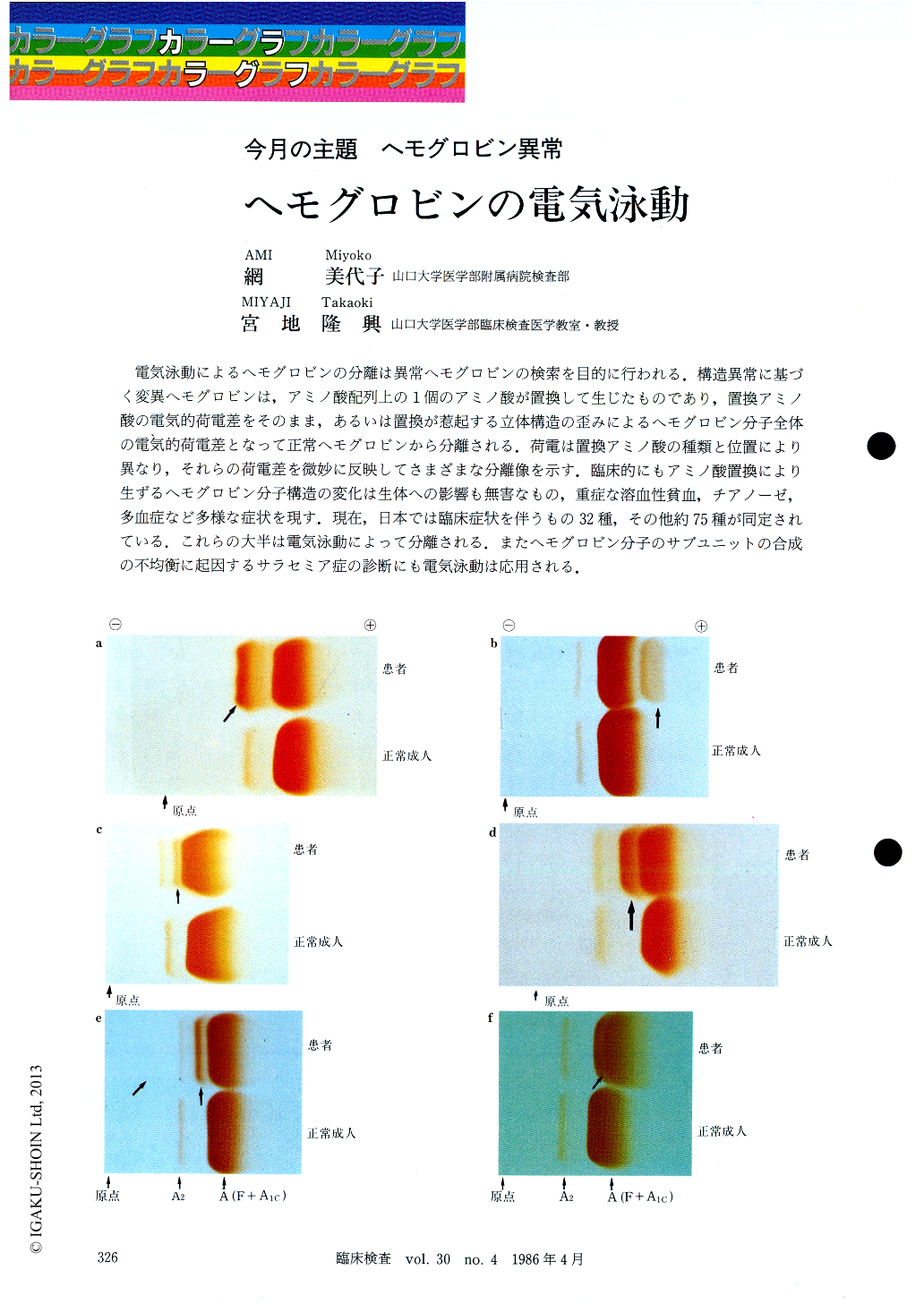 ヘモグロビンの電気泳動 臨床検査 30巻4号 医書 Jp