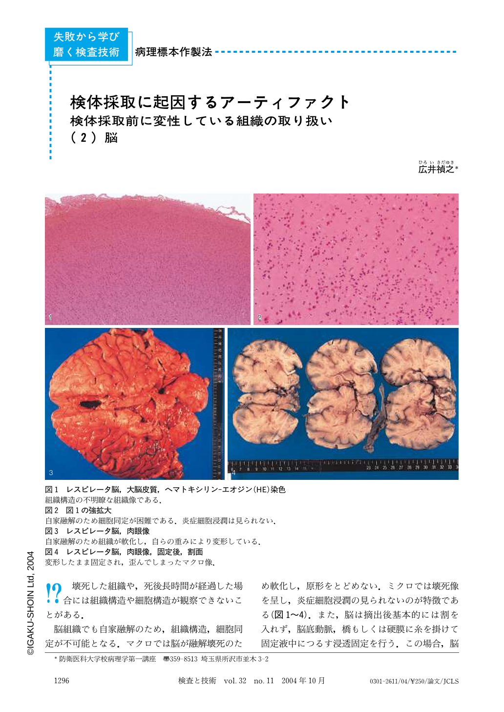 検体採取に起因するアーティファクト 検体採取前に変性している組織の取り扱い 2 脳 検査と技術 32巻11号 医書 Jp