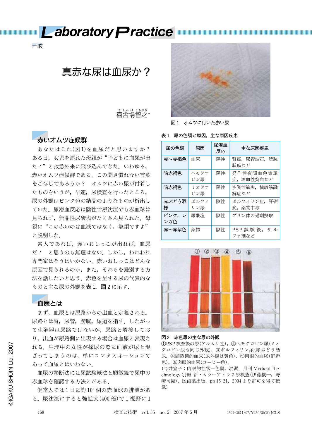 真赤な尿は血尿か 検査と技術 35巻5号 医書 Jp