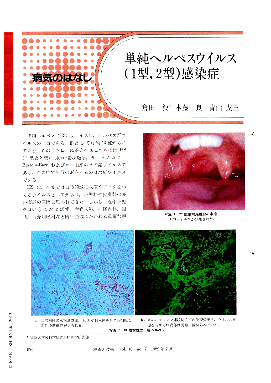 単純ヘルペスウイルス（1型，2型）感染症 (検査と技術 10巻7号) | 医書.jp