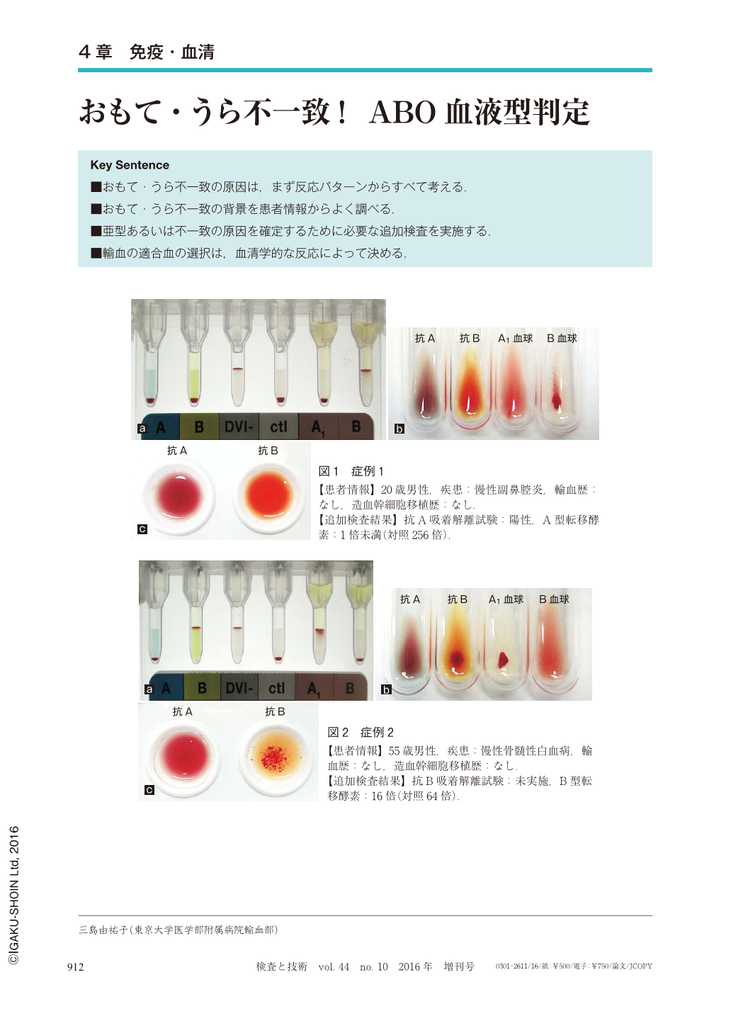 型 検査 血液 「血液型」の検査について［ラボ NO.410（2013.3.発行）より］