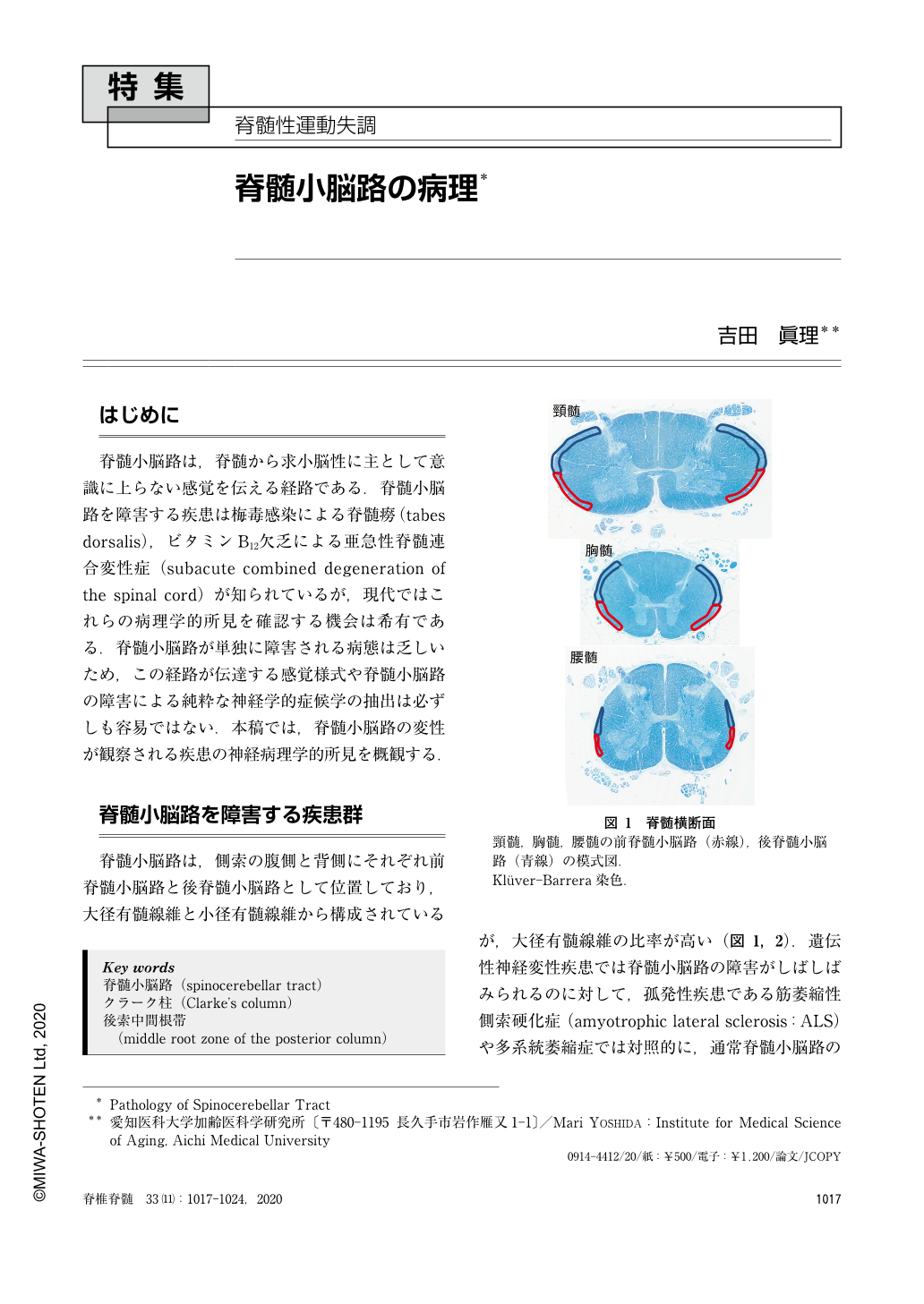 脊髄小脳路の病理 (脊椎脊髄ジャーナル 33巻11号) | 医書.jp