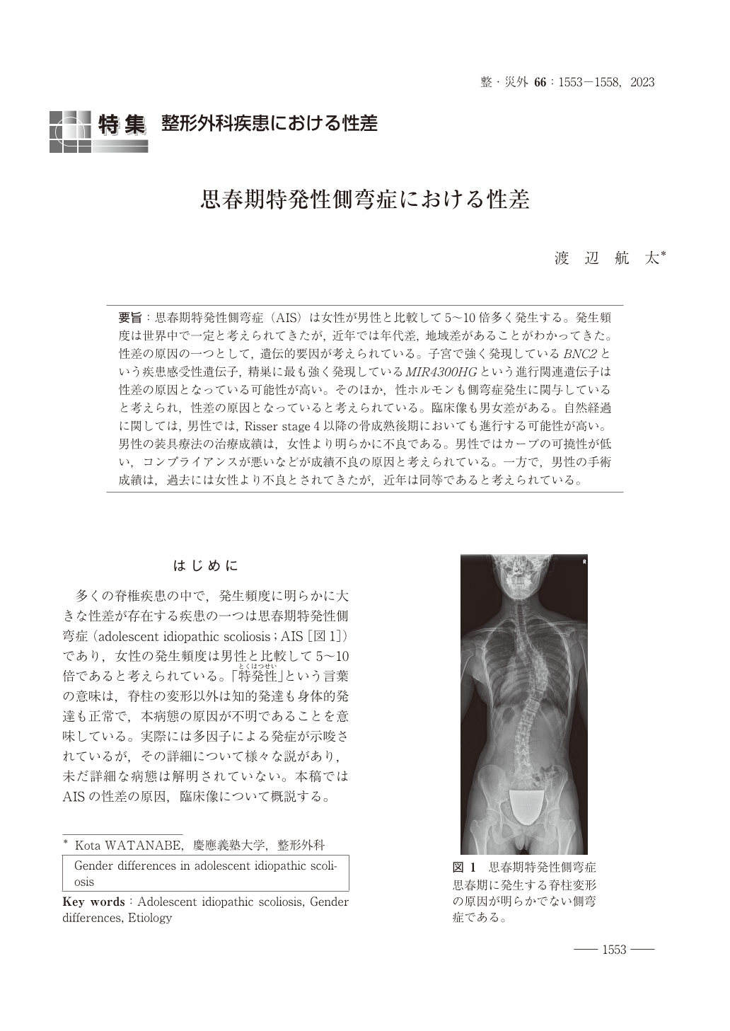 思春期特発性側弯症における性差 (整形・災害外科 66巻13号) | 医書.jp